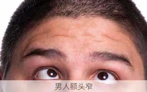 男人额头窄