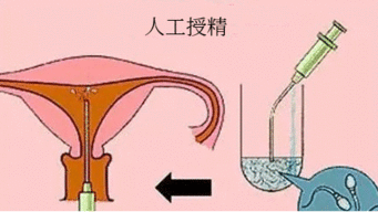 生儿子一定要在排卵前还是后